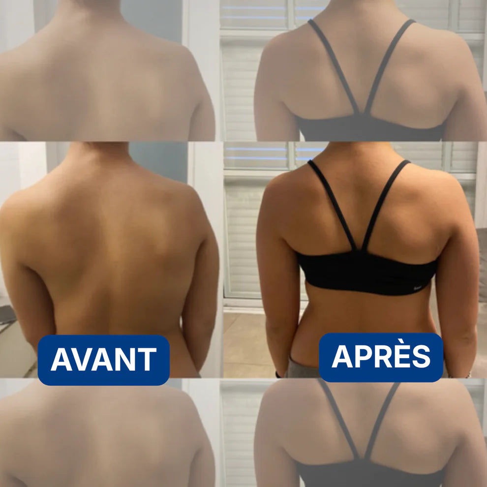 SoulageMAX™ – Correcteur de Posture